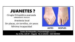 Juanetes Bogota Centro de Ortopedia y Traumatologia