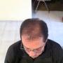 FOTOS ANTES 2
