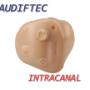 intracanal