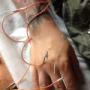 Tratamiento para Tendinitis Aguda (acupuntura)