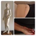 Acupuntura
