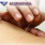 ACUPUNTURA