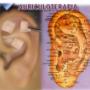 AURICULOTERAPIA