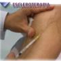 ESCLEROTERAPIA