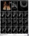 TOMOGRAFIA