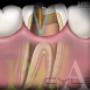 Subido por visitante en 6/10/2016 - Leaser Dental