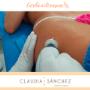 Carboxiterapia