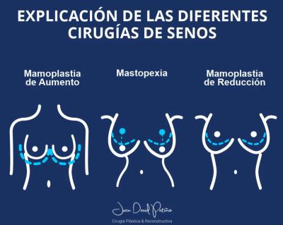 Cirugía-plástica-de-senos