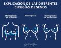 Cirugía plástica de senos