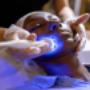 HIDRATACIÓN FACIAL CON DERMAPEN