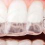 Estética dental