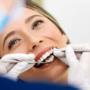 Estética dental