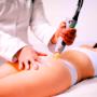 depilación laser en gluteos