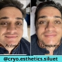 Facial antiedad