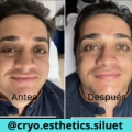 Limpieza facial (1)
