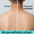 Limpieza facial