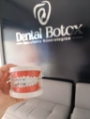 Dental Botox