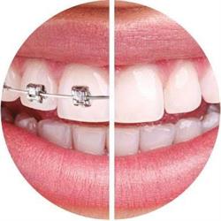 DentalPlus Sabana - Zipaquirá