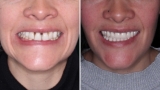 Dental tourism in Colombia